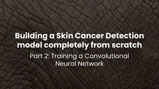 Detecting Skin Cancer Part 2 - Training a Convolutional Neural Network