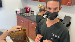 28 Days After Fut Strip Method For Eyebrow Transplantation