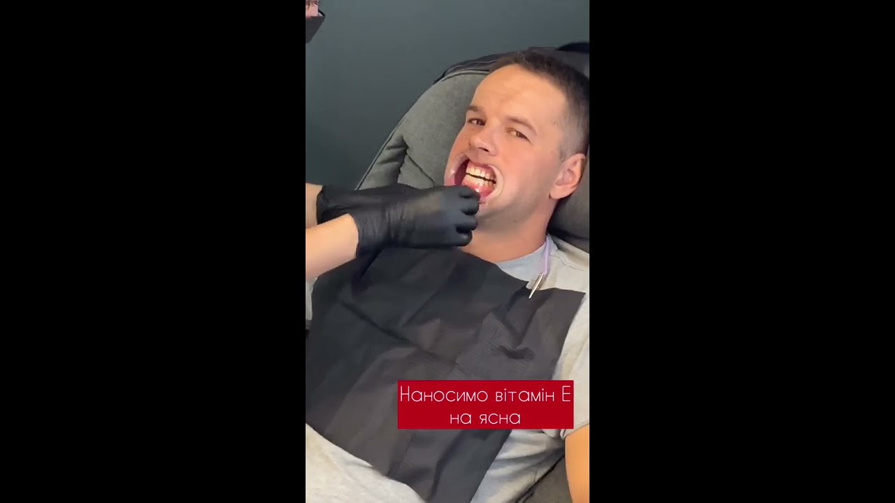 ЧТО ВКЛЮЧАЕТ ПРОЦЕДУРА ОТБЕЛИВАНИЯ? Smilebar