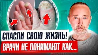 Вышли старые залежи гноя! Врачи не понимают как: РАК, грибок, мигрень, инсульт - исчезают!