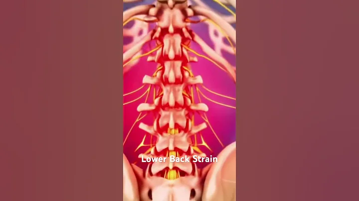 Lower Back Strain