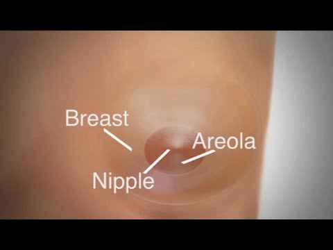 Mastectomy | Breast Reconstruction Overview