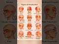 Types of Headaches You Should NEVER Ignore ⚠️ | Migraine vs Stress vs Dangerous Pain #headachefree