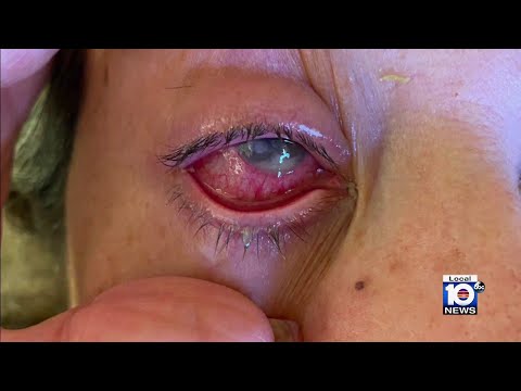 Grandmother claims eyedrops caused blindness