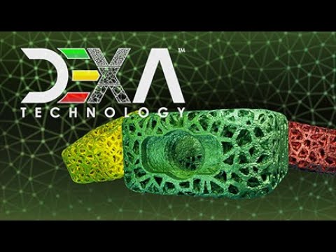 DEXA-C: Color-coded for different bone density