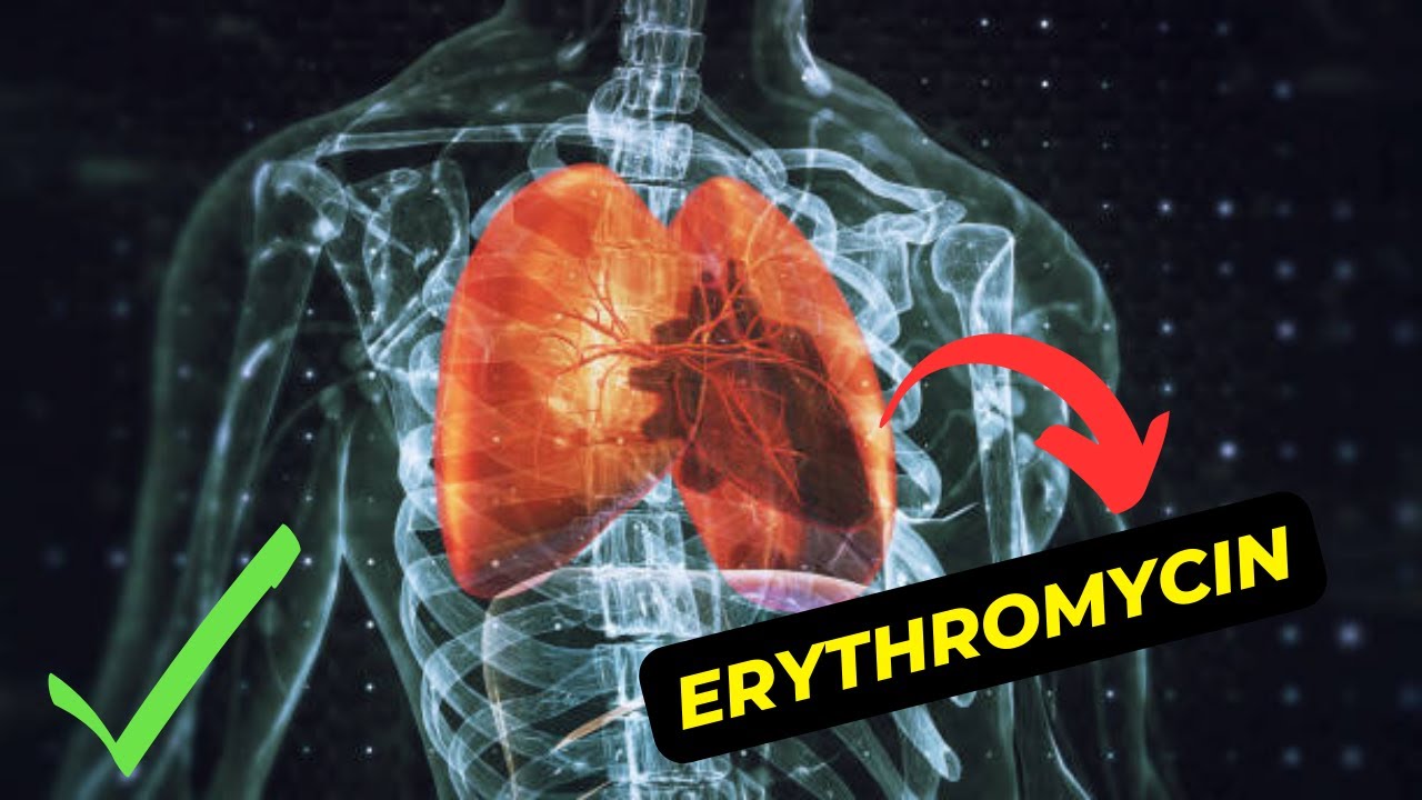 The Benefits Of Erythromycin An Overview Of Antibiotic Treatment YouTube ibuprofen-vs-paracetamol-know-the-difference-firstaidpro