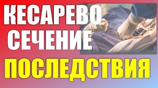 Чем опасно КЕСАРЕВО СЕЧЕНИЕ. Последствия кесарева сечения для женщины и ребёнка