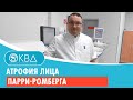 👉 Атрофия лица Парри-Ромберга. Клинический случай №894