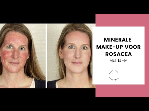 Minerale make-up voor Rosacea || Creative Cosmetics