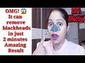 OMG!2Min मे Blackheads हटाए HOW TO REMOVE BLACKHEADS NATURALLY 100% effective|Be Natural