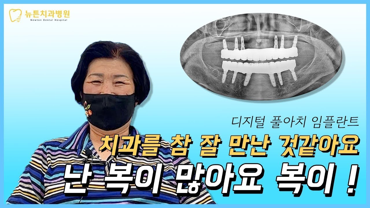 네비게이션 가이드를 이용한 임플란트 후기