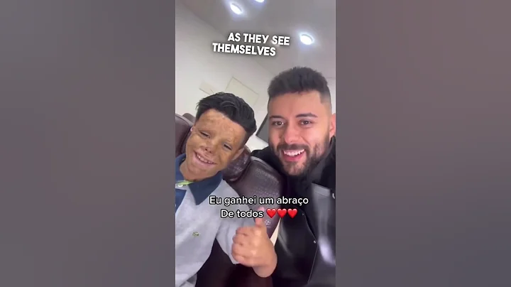 This barber helped children get their hair back ❤️ @Franciscoprotesecapilar - DayDayNews