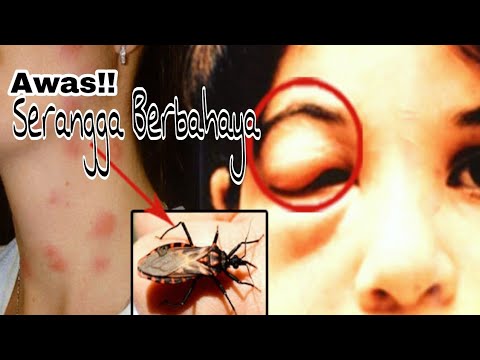 Video: Gigitan Serangga, Larva Serangga Amfibi