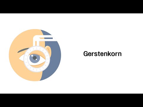 Video: Äußerer Augenlidschwamm (Hordeolum Externum)