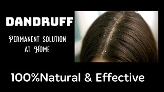 Dandruff treatment at home# permanent solution# कोंडा होण्याची कारणे उपाय आणि होम रेमेडिज.