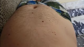 Stomach Sounds - Popeyes Aftermath