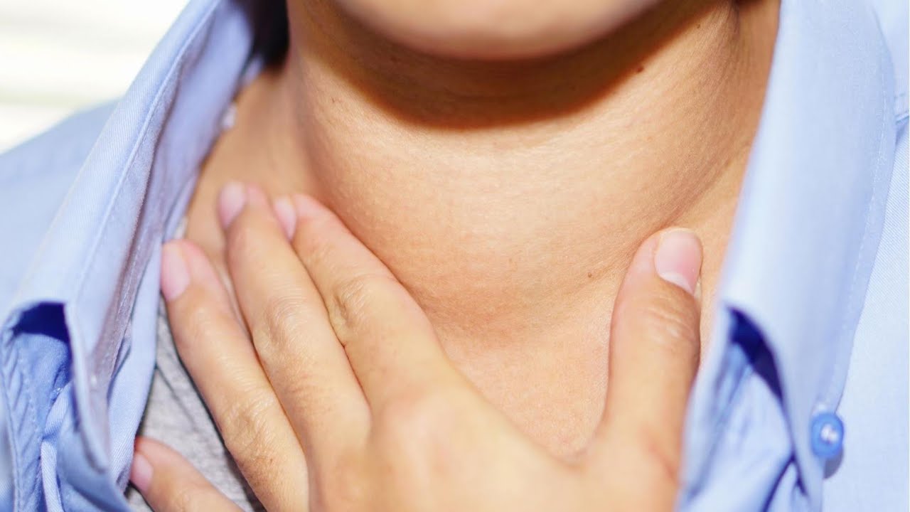 ACUPUNCTURE TREATMENT FOR LARGE, SOFT GOITER WITH DEPRESSION AND IRRITABILITY