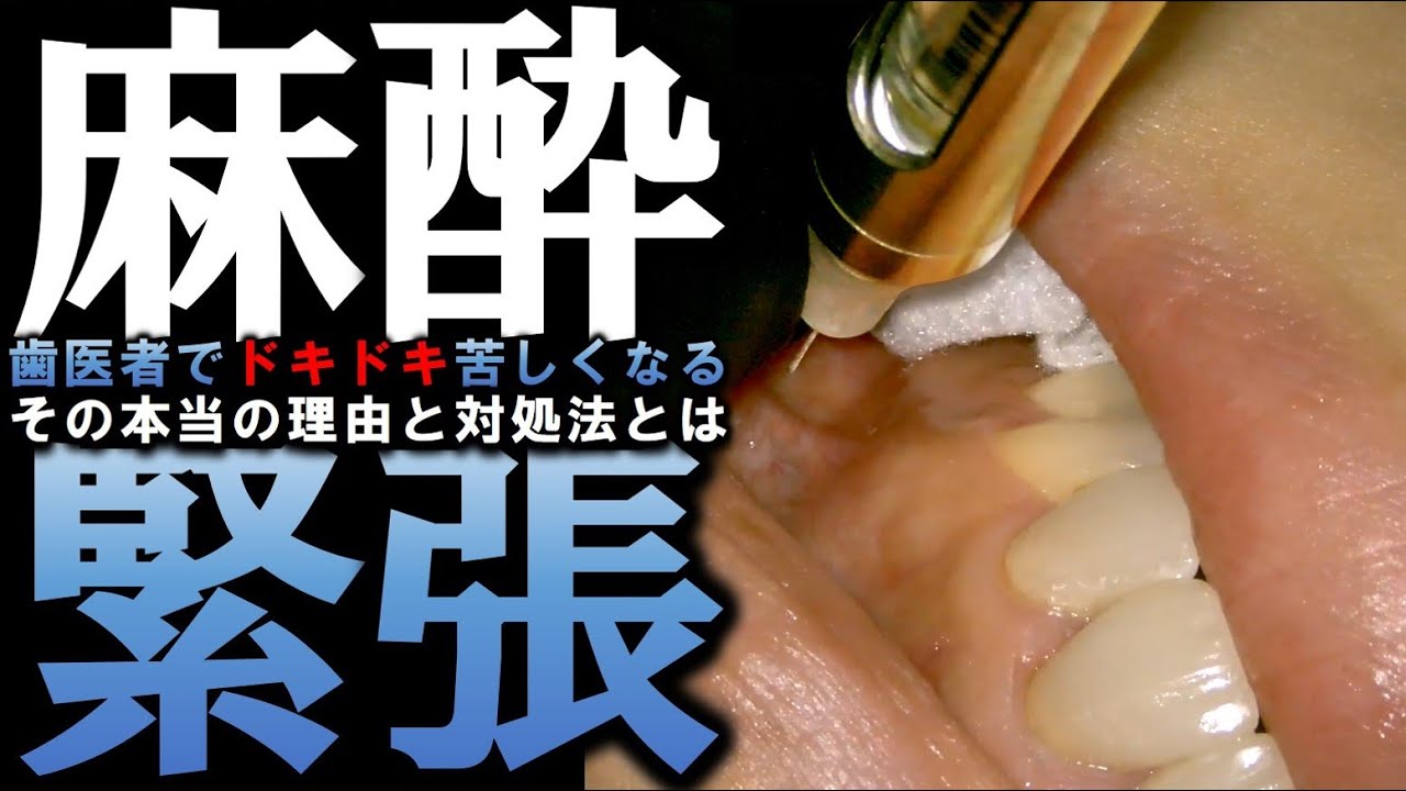 【 皆知らない 】歯医者でドキドキ苦しくなる！？その本当の理由と対処法とは！