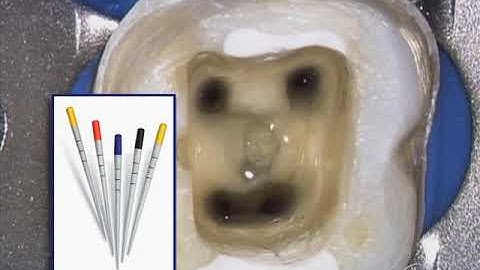 Shape Clean Pack: 3D Obturation - Concepts, Objectives, & Tools: Dr. Ruddle Advanced Endodontics
