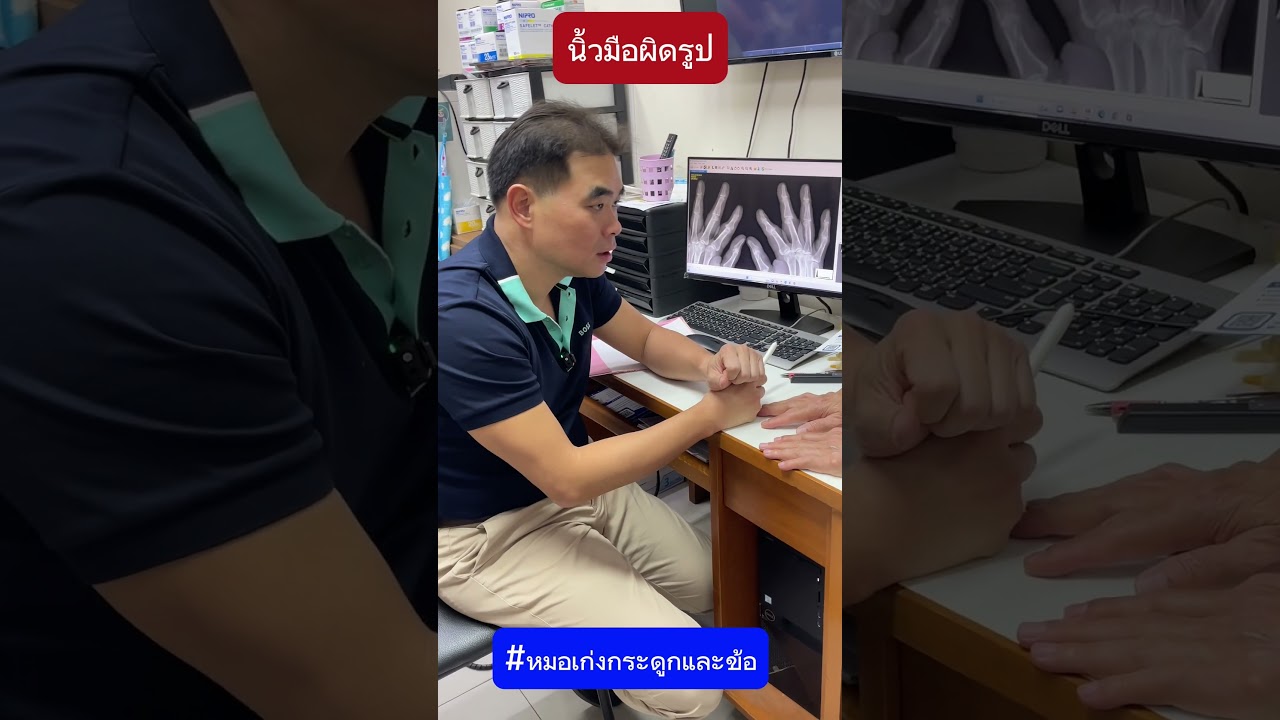 นิ้วมือผิดรูป #หมอเก่งกระดูกและข้อ #นิ้วผิดรูป #ข้อเสื่อม
