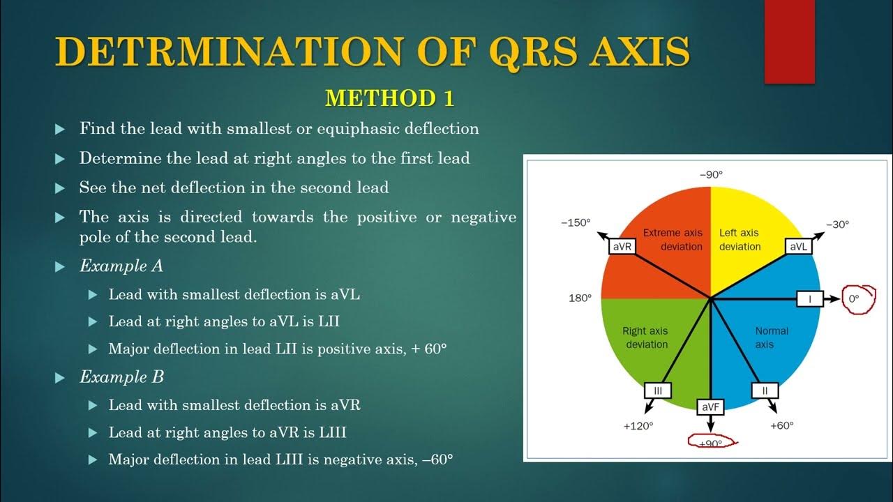 ECG Axis Determination II Normal Heart Axis II Left Axis & Right Axis ECG Axis Determination II Normal Heart Axis II Left Axis & Right Axis