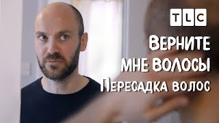 Пересадка волос | Верните мне волосы | TLC