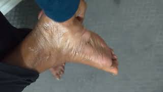 Okeefes Healthy Feet Review. Does Not Work. Overpriced And Doesnt Work.