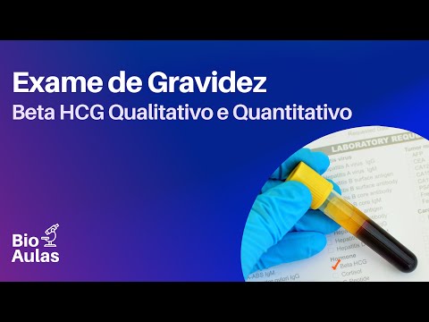 Exame Beta HCG