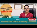 FAQs on Chemical Peeling Explained by Dr. Jangid | SkinQure | Delhi