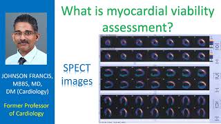 What is myocardial viability assessment?