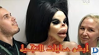 أبشع 10 عمليات التجميل انتهت بنتائج كارثية!