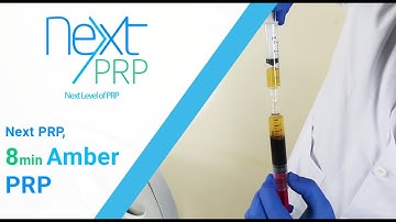 Next PRP, 8 min Amber PRP (from T-Lab)
