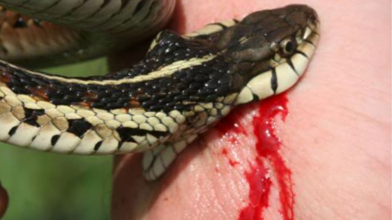 Image result for snake bite