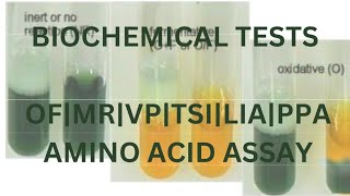 Biochemical Tests for the Identification of Bacteria|PART 2
