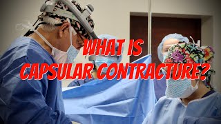 What is Capsular Contracture after Breast Augmentation?