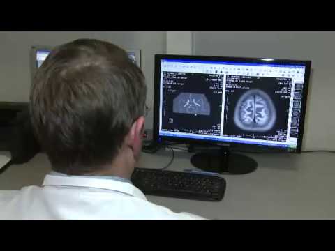 Диагностика рассеянного склероза