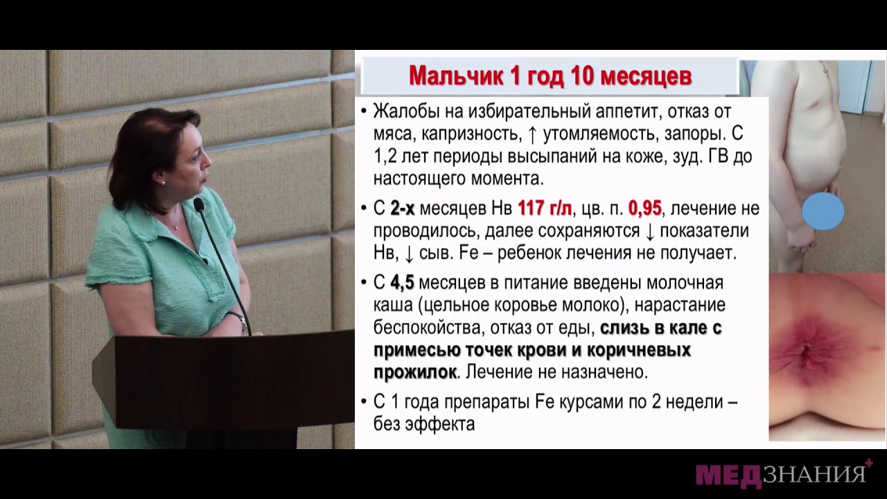 06 Дифференциальный диагноз анемий у детей