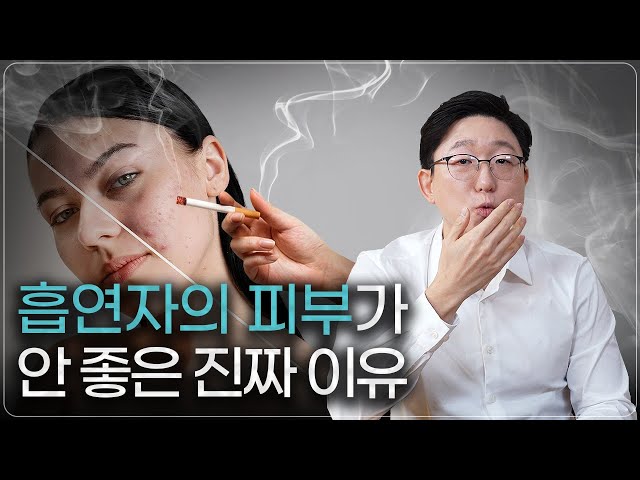 담배가 피부에 안 좋은 '진짜' 이유? (전자담배 포함) ㅣ 피부과전문의