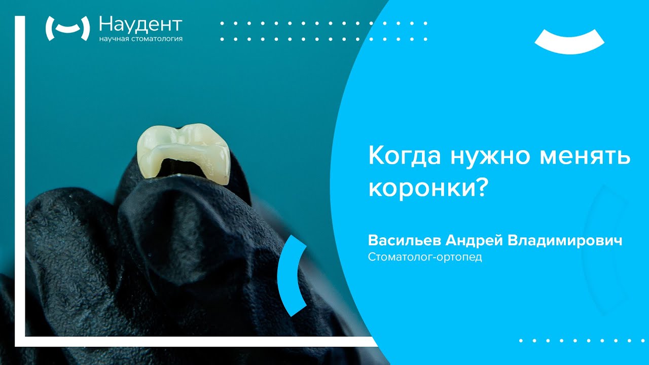 👉 Когда нужно менять коронки?