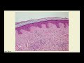 Basics of Dermatology (Part One) - CRASH! Medical Review Series