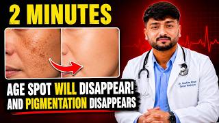 AGE SPOTS WILL DISAPPEAR! 5 Hidden Causes Your Doctor Never Talks About | Dr. Ibrahim Khan