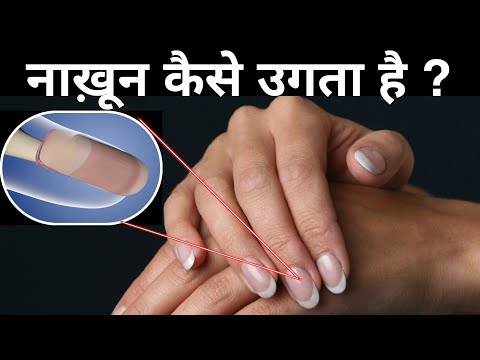 वीडियो: क्या नाखून प्लेट वापस बढ़ेगी?