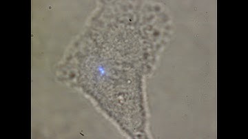 Trapped single upconversion nanoparticles vs nanoparticles inside cells