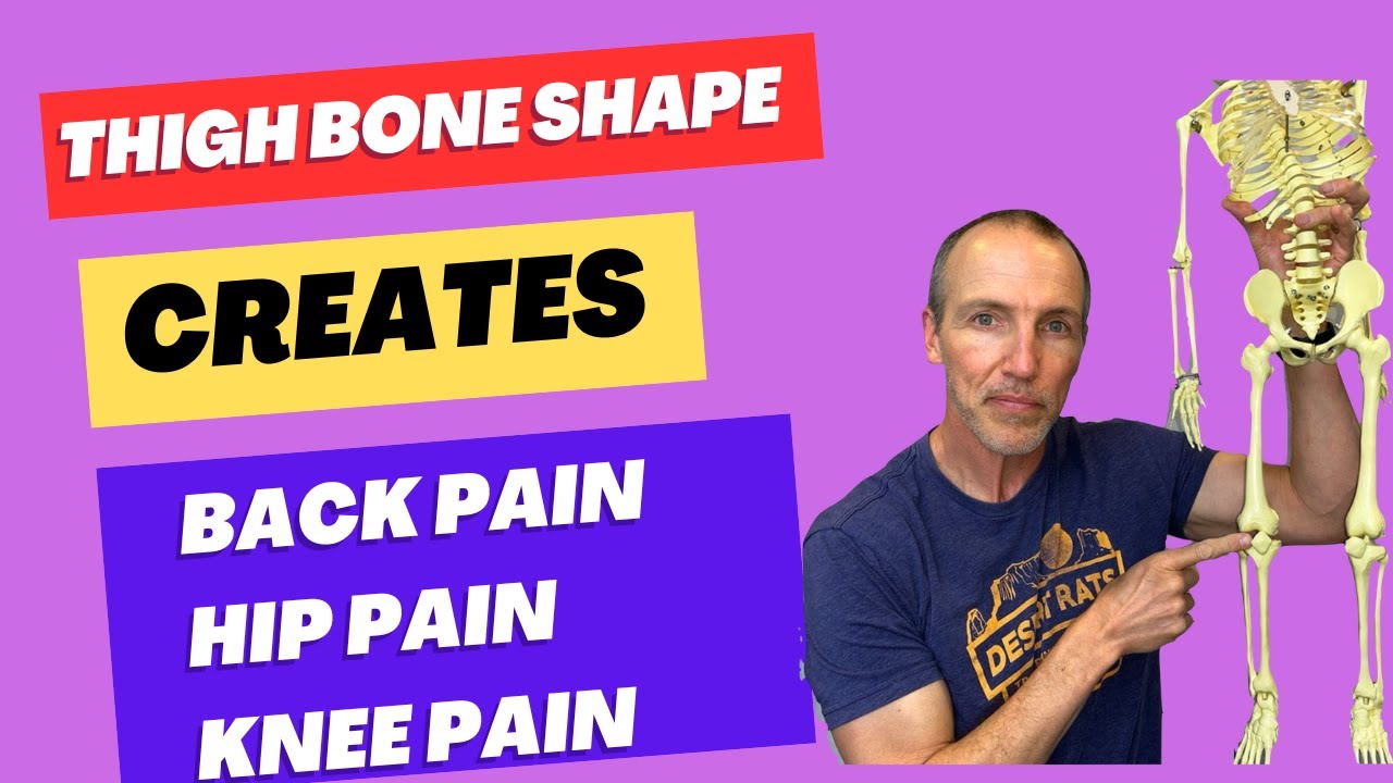 Thigh Bone Alignment Causing Back, Hip & Knee Pain? | Femoral Anteversion Exposed