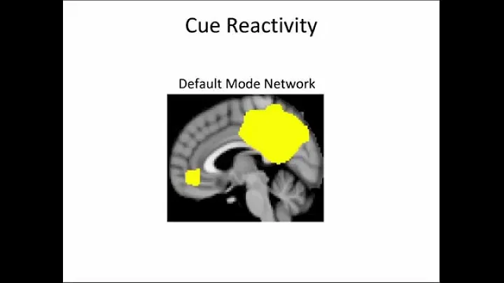 Dr Amy Janes: Cognition and Connectivity:  Neuroim...