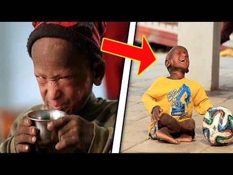 Wideo: 11-letni Chłopiec Trzyma W Dłoni ślimaka - Alternatywny Widok