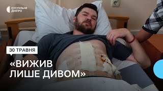 «Таке поранення - майже завжди см*рть»: в одному з медзакладів Дніпропетровщини лікують військового