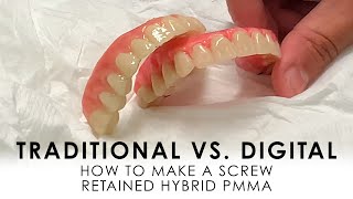 Traditional vs. Digital: How to make Screw Retained Hybrid PMMA