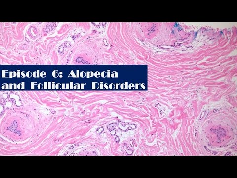قسمت 6: آلوپسی و اختلالات فولیکولی