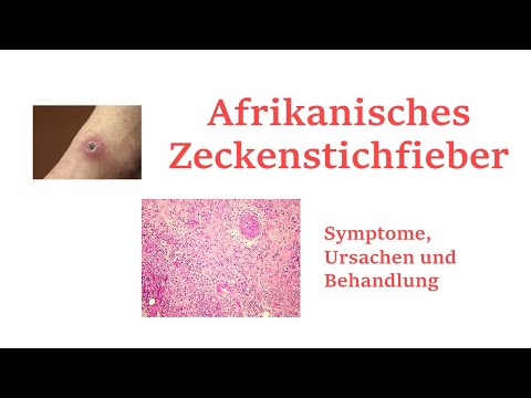 Video: Anzeichen von Zeckenfieber bei Hunden